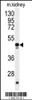 Western blot analysis of POLDIP2 antibody in mouse kidney tissue lysates (35ug/lane)