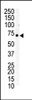 Western blot analysis of anti-EphB6 C-term Pab in Jurkat cell lysate