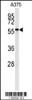 Western blot analysis of NAB2 antibody in A375 cell line lysates (35ug/lane)