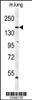 Western blot analysis of KDR (Y1175) Antibody in mouse lung tissue lysates (35ug/lane)