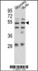 Western blot analysis in NCI-H460, HL-60 cell line lysates (35ug/lane) .This demonstrates the Sestrin-1 antibody detected the Sestrin-1 protein (arrow) .
