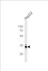 Western blot analysis of lysate from HepG2 cell line, using MPST Antibody at 1:1000 at each lane.