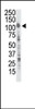 Western blot analysis of anti-InsRR Pab in A375 cell lysate. Lane A: preimmune, Lane B: purified antibody