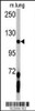 Western blot analysis of PDGFRA antibody (C-term E1063) in mouse lung tissue lysates (35ug/lane)