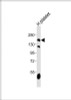 Western Blot at 1:1000 dilution + human platelet lysates Lysates/proteins at 20 ug per lane.