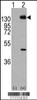 Western blot analysis of PDGFRA using rabbit polyclonal PDGFRA Antibody (Y768) using 293 cell lysates (2 ug/lane) either nontransfected (Lane 1) or transiently transfected with the PDGFRA gene (Lane 2) .