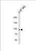 Western blot analysis of lysate from U-87 MG cell line, using TYRO3 Antibody at 1:1000 at each lane.
