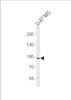 Western blot analysis of lysate from U-87 MG cell line, using TYRO3 Antibody at 1:1000 at each lane.