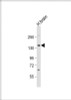 Western Blot at 1:1000 dilution + human brain lysate Lysates/proteins at 20 ug per lane.