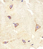 Immunohistochemical analysis of paraffin-embedded H. brain section using TrkC Antibody. Antibody was diluted at 1:100 dilution. A undiluted biotinylated goat polyvalent antibody was used as the secondary, followed by DAB staining.