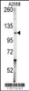 Western blot analysis of anti-ABL1 Antibody in A2058 cell line lysates (35ug/lane)