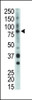 Antibody is used in Western blot to detect BMX in mouse heart tissue lysate.