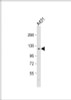 Western Blot at 1:1000 dilution + A431 whole cell lysate Lysates/proteins at 20 ug per lane.