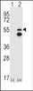 Western blot analysis of FRK using rabbit polyclonal FRK Antibody (V28) using 293 cell lysates (2 ug/lane) either nontransfected (Lane 1) or transiently transfected (Lane 2) with the FRK gene.