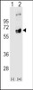 Western blot analysis of FYN using rabbit polyclonal FYN Antibody using 293 cell lysates (2 ug/lane) either nontransfected (Lane 1) or transiently transfected (Lane 2) with the FYN gene.