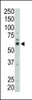 Western blot analysis of anti-FYN Pab in mouse liver tissue lysate