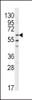 Western blot analysis of anti-LYN Antibody in HL60 cell line lysates (35ug/lane)