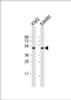 Western Blot at 1:1000 dilution Lane 1: K562 whole cell lysate Lane 2: SW480 whole cell lysate Lysates/proteins at 20 ug per lane.