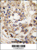 Formalin-fixed and paraffin-embedded human testis tissue reacted with PDX1 Antibody, which was peroxidase-conjugated to the secondary antibody, followed by DAB staining.