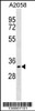 Western blot analysis in A2058 cell line lysates (35ug/lane) .