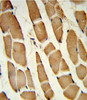 Formalin-fixed and paraffin-embedded human skeletal muscle reacted with SMAD4 Antibody, which was peroxidase-conjugated to the secondary antibody, followed by DAB staining.