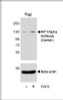 Western blot analysis of lysates from Raji cell line, untreated or treated with CoCl2 (0. 1mM) , using HIF1Alpha Antibody (upper) or Beta-actin (lower) .