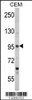 Western blot analysis of SEMA3A Antibody in CEM cell line lysates (35ug/lane)