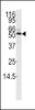 Western blot analysis of anti-CAMKK1 Antibody in mouse thymus tissue lysates (35ug/lane)