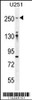 Western blot analysis in U251 cell line lysates (35ug/lane) .This demonstrates the FLNA antibody detected the FLNA protein (arrow) .