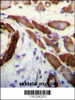FLNA Antibody (Y1046) immunohistochemistry analysis in formalin fixed and paraffin embedded human skeletal muscle followed by peroxidase conjugation of the secondary antibody and DAB staining.This data demonstrates the use of FLNA Antibody (Y1046) for immunohistochemistry.