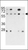 Western blot analysis of PR48 antibody in 293, NCI-H460, Hela, K562 and HL60 cell line lysates (35ug/lane)