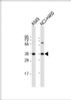 Western Blot at 1:1000 dilution Lane 1: A549 whole cell lysate Lane 2: NCI-H460 whole cell lysate Lysates/proteins at 20 ug per lane.