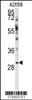 Western blot analysis of anti-WBP2 Antibody in A2058 cell line lysates (35ug/lane)