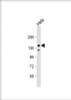 Western Blot at 1:1000 dilution + Hela whole cell lysate Lysates/proteins at 20 ug per lane.