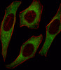 Fluorescent image of Hela cell stained with IRS2 Antibody .Hela cells were fixed with 4% PFA (20 min) , permeabilized with Triton X-100 (0.1%, 10 min) , then incubated with IRS2 primary antibody (1:25) . For secondary antibody, Alexa Fluor 488 conjugated donkey anti-rabbit antibody (green) was used (1:400) .Cytoplasmic actin was counterstained with Alexa Fluor 555 (red) conjugated Phalloidin (7units/ml) .IRS2 immunoreactivity is localized to Cytoplasm significantly.