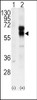 Western blot analysis of ACVRL1 using rabbit polyclonal ACVRL1 Antibody using 293 cell lysates (2 ug/lane) either nontransfected (Lane 1) or transiently transfected with the ACVRL1 gene (Lane 2) .