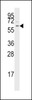 Western blot analysis of anti-TGFBR1 Pab in Jurkat cell line lysates (35ug/lane)