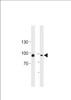 Western blot analysis in HUVEC, K562 cell line lysates (35ug/lane) .This demonstrates the TGM2 antibody detected the TGM2 protein (arrow) .