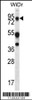 Western blot analysis in WiDr cell line lysates (35ug/lane) .