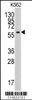 Western blot analysis of anti-YARS2 Antibody in K562 cell line lysates (35ug/lane)