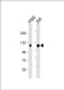 Western Blot at 1:1000 dilution Lane 1: K562 whole cell lysate Lane 2: 293 whole cell lysate Lysates/proteins at 20 ug per lane.