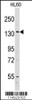 Western blot analysis of anti-VARS Antibody in HL60 cell line lysates (35ug/lane)