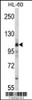 Western blot analysis of MARS Antibody in HL-60 cell line lysates (35ug/lane)