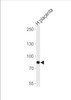 Western blot analysis in human placenta tissue lysate (35ug/lane) . This demonstrates that the detected AMPD3 protein (arrow) .