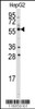 Western blot analysis of anti-ALDH4A1 Antibody in HepG2 cell line lysates (35ug/lane) .