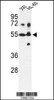 Western blot analysis of CYP21A2 Antibody in 293, HL-60 cell line lysates (35ug/lane)