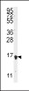 Western blot analysis of anti-ALOX5AP Antibody in K562 cell line lysates (35ug/lane) .