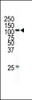 Western blot analysis of anti-MEKK1 Pab in HL-60 cell lysate