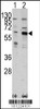 Western blot analysis of PAK3 using rabbit polyclonal PAK3 Antibody using 293 cell lysates (2 ug/lane) either nontransfected (Lane 1) or transiently transfected with the PAK3 gene (Lane 2) .