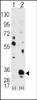 Western blot analysis of PIM1 using PIM1 Antibody using 293 cell lysates (2 ug/lane) either nontransfected (Lane 1) or transiently transfected with the PIM1 gene (Lane 2) .